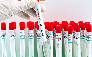Negatywne wyniki testów na obecność koronawirusa w Stomilu Olsztyn
